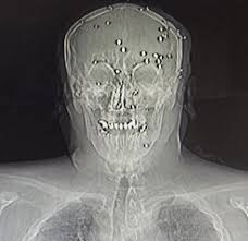 66 timer i helvete: – Jeg sover fremdeles ikke om natten