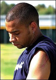 The wounds Army paratrooper Howard &quot;Kobie&quot; Johnson acquired on June 9 in Iraq are still visible on his shoulder as he shows them to his stepmother while ... - 122b