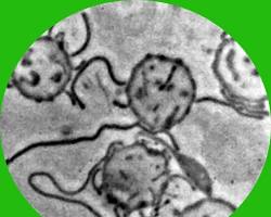 Obraz: Borrelia burgdorferi bakteria pod mikroskopem