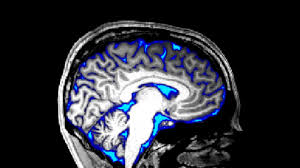 

Stimulating Cerebrospinal Fluid Flow in the Awake Brain