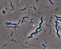 صورة Spirilla bacteria