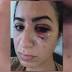 Uber driver allegedly punches woman in the face in Atlanta