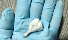 Otel ve gece kulüplerine uyuşturucu operasyonu