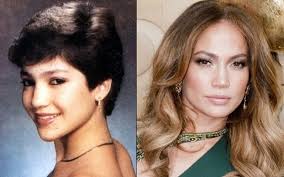 Resultado de imagem para antes e depois dos artistas brasileiros
