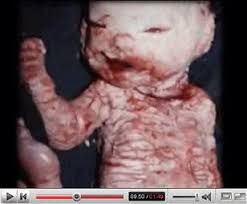 Image result for depleted+uranium+babies