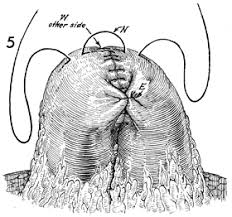 Image result for simple continuous suture pattern