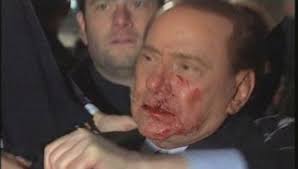 L&#39;aggressore di Silvio Berlusconi è Massimo Tartaglia, un uomo di 42 anni dieci dei quali in cura ... - Silvio-Berlusconi-aggredito-da-Massimo-Tartaglia1