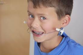 extraoral appliance orthodontics types ile ilgili görsel sonucu