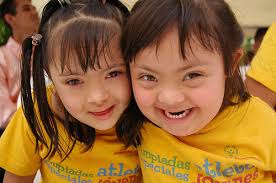 Resultado de imagen para Síndrome de hipoconexión.