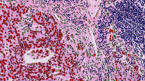 Revolutionary Integrated Pathology Unit in England Utilizes Advanced Technology for Cancer Diagnosis and Clinical Trials