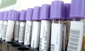 Test tubes for clinical trials