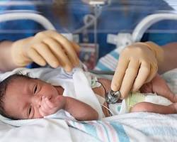 newborn baby in a neonatal intensive care unit (NICU)
