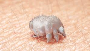 "Urgent Air Freight of Scabies Treatment Cream to New Zealand as South Island Faces Surge in Cases"