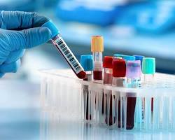 Laboratory tests for general checkup