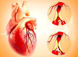 Is There a Link Between the Hours Worked, Chronic Stress, and Coronary Heart Disease?