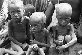 Resultado de imagen para el hambre en africa