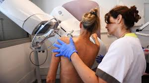 New Guidelines for Mammograms at Age 40 in the United States