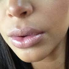 Lip Plumper Lip Gloss-Plumper Lips