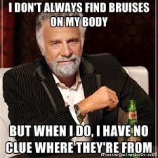 As a guy who doesn&#39;t bruise easily...but I&#39;m sure lots of you can ... via Relatably.com
