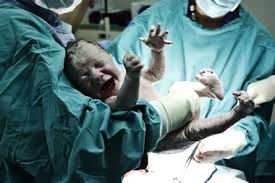 Resultado de imagem para nascimentos de bebe parto normal