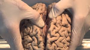 Introduction: Neuroanatomy Video Lab - Brain Dissections - YouTube