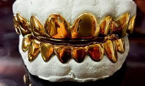 Image result for gold teeth