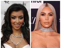 Imagen de Kim Kardashian before and after plastic surgery