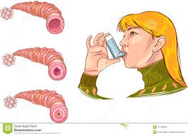 Afbeeldingsresultaat voor astma
