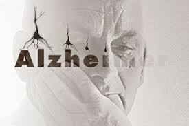 Risultati immagini per alzheimer anziani