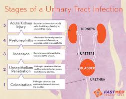 Image result for urinary tract infection