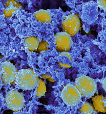 Common childhood Antibiotic Resistance: A Growing Concern for Common Childhood Infections