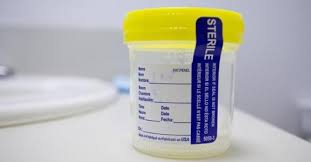 Imagini pentru test urina