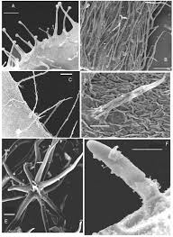 A – Multiseriate glandular trichomes; Hieracium amplexicaule (scale ...