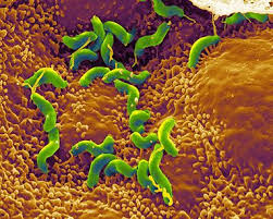 Afbeeldingsresultaat voor helicobacter pylori afbeeldingen