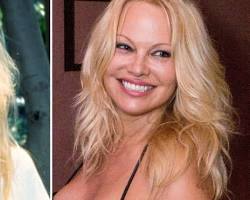 Imagen de Pamela Anderson before and after plastic surgery