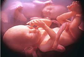 Image result for abortion is killing