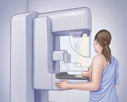 Image of Mammogram
