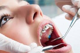 Image result for orthodontist