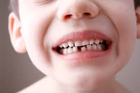 Image result for baby teeth coming in