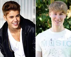 Imagen de Justin Bieber before and after plastic surgery