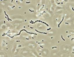 Streptococcus iniae