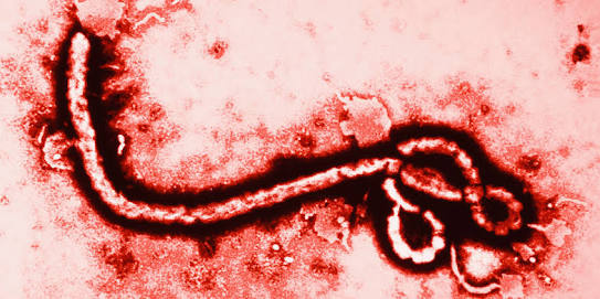 El Ebola Llega a América 