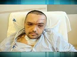 Esta é a foto que mostra como ficou o rosto do ex-deputado Luiz Fernando Ribas Carli Filho, depois do acidente do dia 7 de maio, que provocou a morte de ... - carli-filho