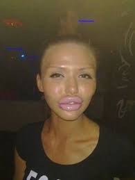 Staaaap it!!!! on Pinterest | Plastic Surgery, Botox Lips and Plastic via Relatably.com