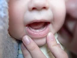 Прорезывание зубов у детей.
