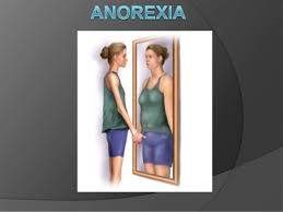 Resultado de imagen para imagenes de anorexia