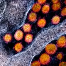 COVID-19 Breaks From Seasonal Spread of Influenza: Report