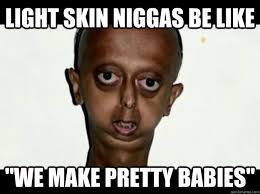 Light skin niggas be like &quot;we make pretty babies&quot; - Black progeria ... via Relatably.com