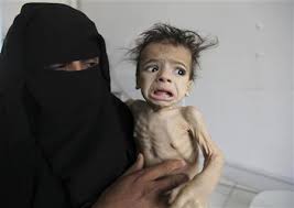 Resultado de imagem para children of Yemen