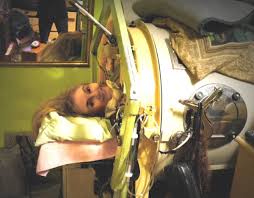 Image result for iron lung